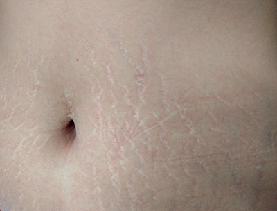 口岸婦科：女性健康的重要守護者